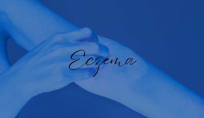 images/Copy%20of%20Copy%20of%20Vitiligo.jpg#joomlaImage://local-images/Copy of Copy of Vitiligo.jpg?width=704&height=409