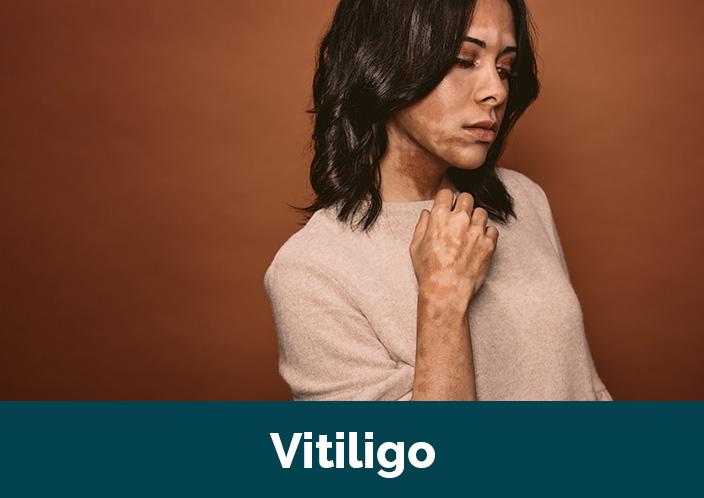 images/Featured-Studies/vitiligo-medical-study-lynchburg-va-education-research-foundation.jpg#joomlaImage://local-images/Featured-Studies/vitiligo-medical-study-lynchburg-va-education-research-foundation.jpg?width=704&height=498